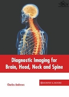 Diagnostic Imaging for Brain, Head, Neck and Spine | تصویربرداری تشخیصی برای مغز، سر، گردن و ستون فقرات